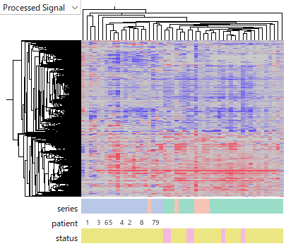 Hierarchical clustering of lesional and chronic lesion AD samples after patient-paired log2 ratio transformation using non-lesional samples as references